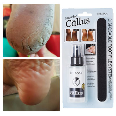 Qoo10 ザサック 振りかけすぐ削除足の角質パタパタthes ボディ ハンド フットケア Qoo10 ザサック 振りかけすぐ削除足の角質パタパタthes ボディ ハンド フットケア