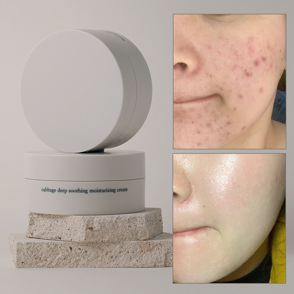 キャベッジ スージング クリーム 150ml 2個セット 5,397円