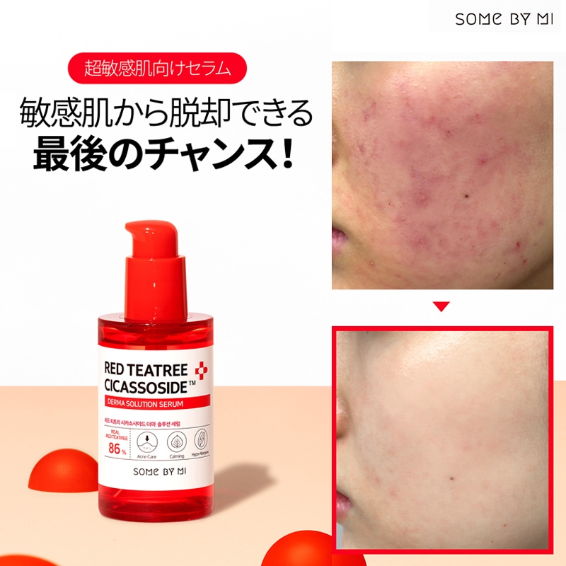 Qoo10] サムバイミー レッドティーツリーシカソサイドソリューシ 