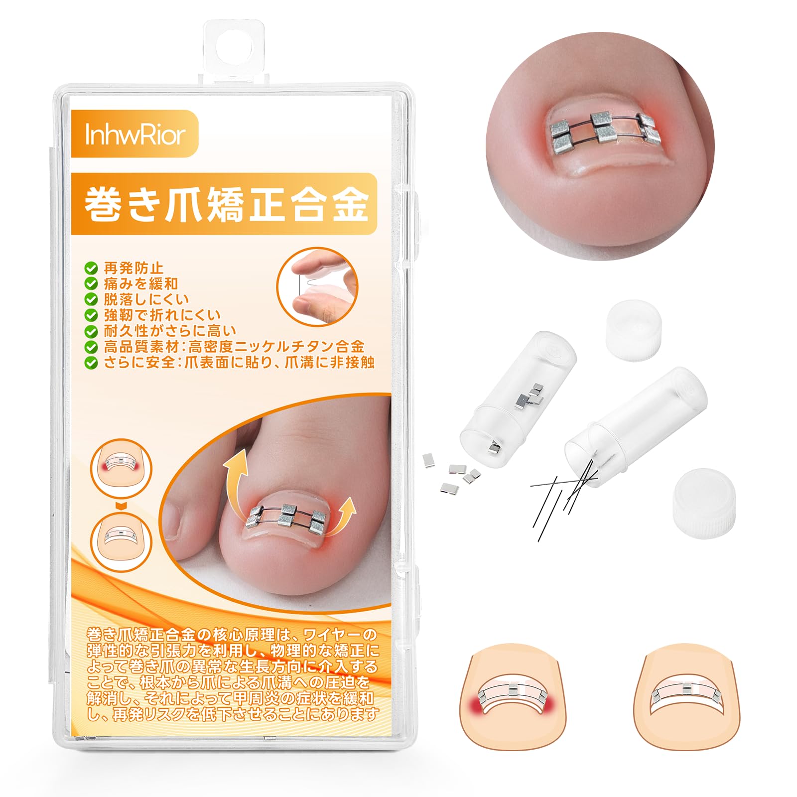 InhwRior 巻き爪矯正合金 記憶ニッケルチタン線採用 高耐久性 繰り返し使用可能 大部分の巻き爪（陥入爪）足指に対応 サイズ選び不要 自宅で手軽に装着 巻き爪痛み緩和