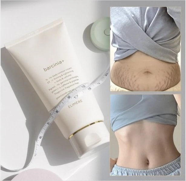 バルシニア ボディローション セルライト クリーム 300ml