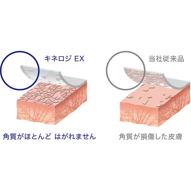 ニトリート NITREAT キネロジ EX テーピング用品 (NKEX37)