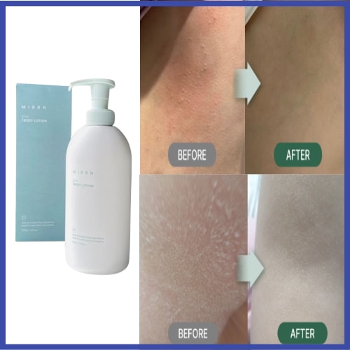 韓国ミルエン シカ 高保湿/極乾性/ボディローション 若芽エキス/肌保湿剤/香りの良い大容量500ml/ツボクサエキス/湿疹アトピーかゆみケア/妊婦/妊娠線/ベビーローション