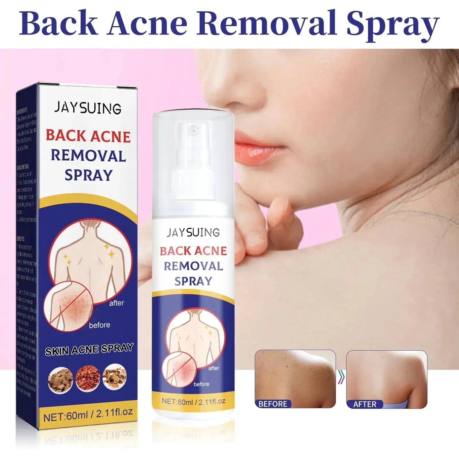 1つ買うと10個無料背中のケアスプレーは背中のニキビを薄めるニキビ跡の柔らかい肌の清潔なケア17