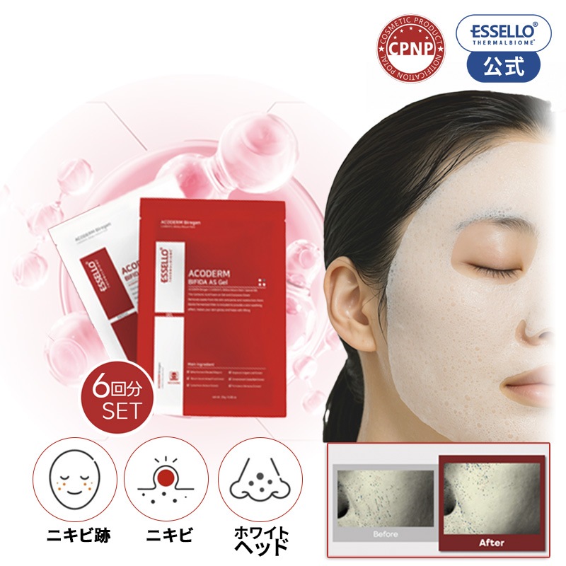 炭酸バブル パック ニキビ跡 ニキビ 角質ケア 毛穴 リターンマスク パック エイコダム バイアゼン ペプチド 温泉水 ニキビ跡 ニキビ フェイスマスクパック essello