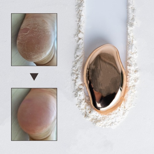 [SNS 人気] VANDLUV 足ケラチン除去器 1+1