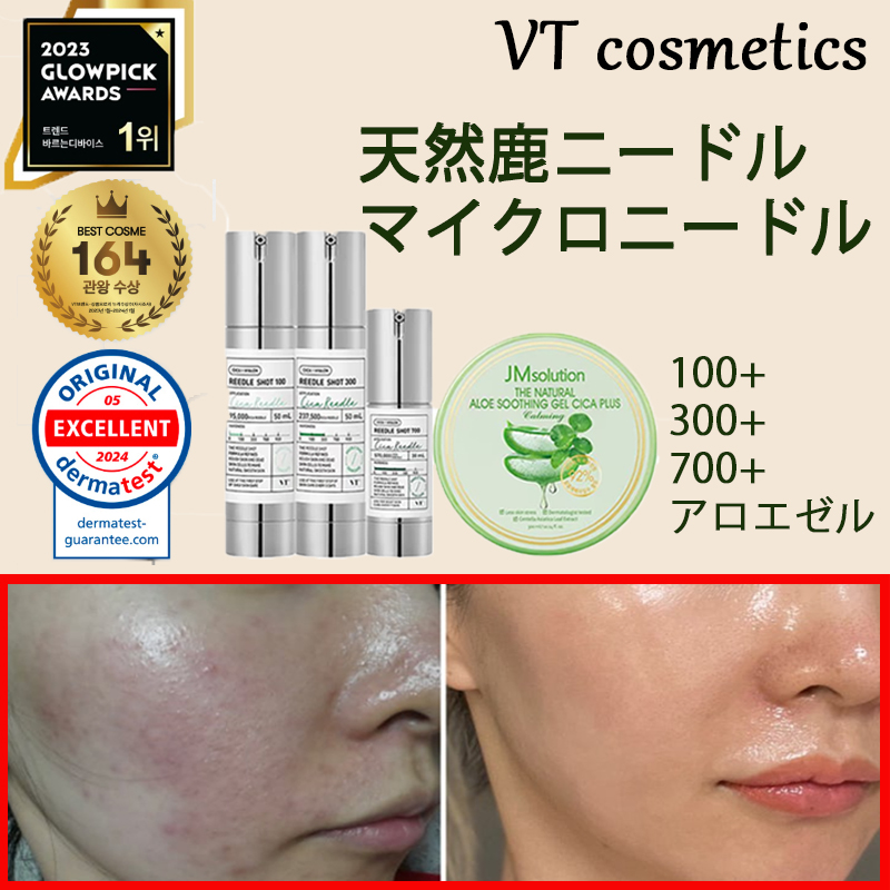 リードルショット 3点セット(100 + 300 + 700)+ アロエジェル / 人気 韓国コスメ 塗る マイクロシカ ニードル ホームケア アロエジェル肌の鎮静 毛穴ケア 保湿 水分クリーム