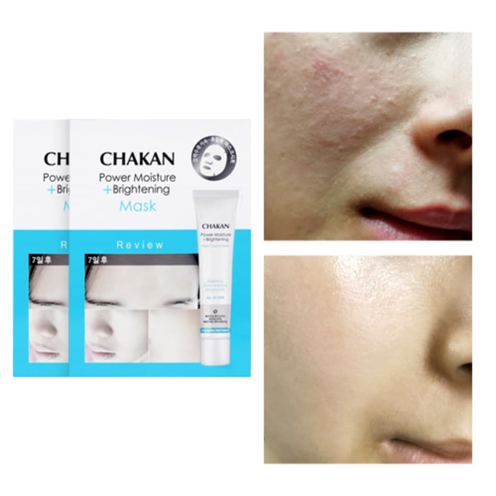 シミ ジャブティ そばかす 輝き シミ ジャブティ マスクパック, 10個入り, 2個