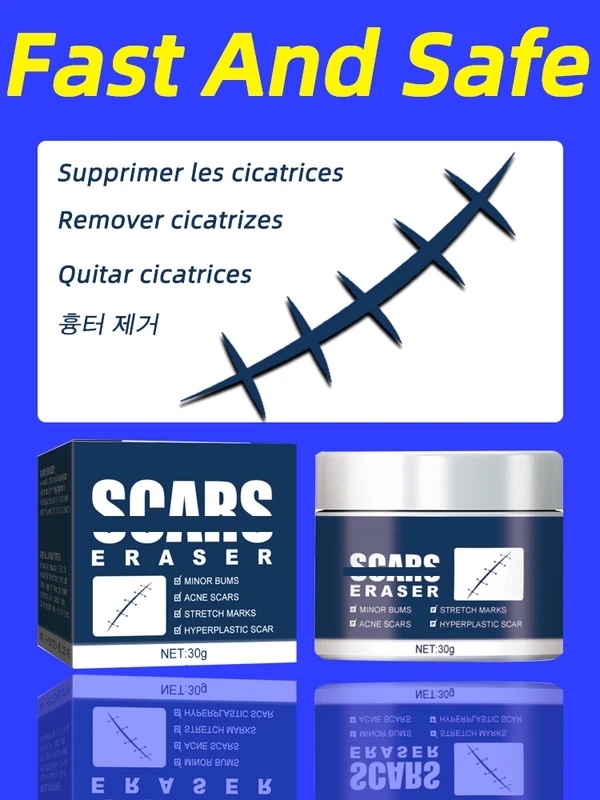 ケロイドクリーム