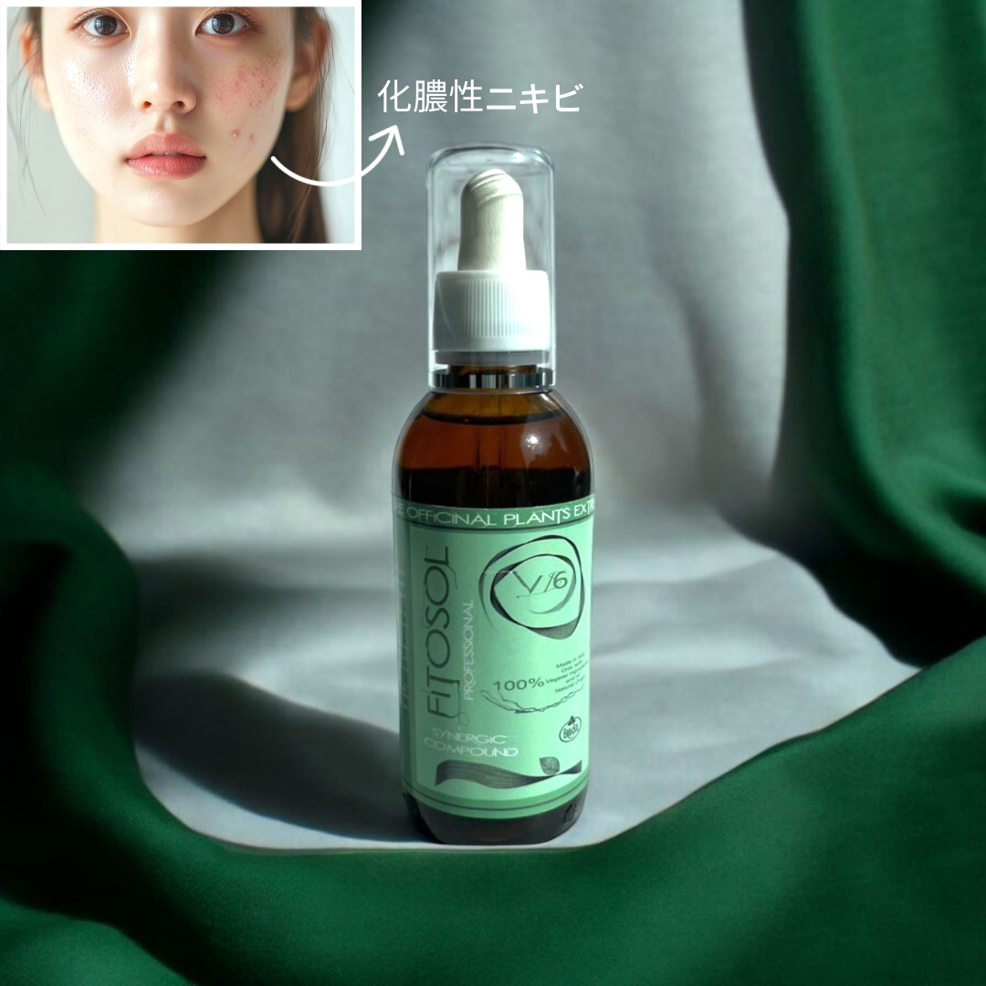 ERBASOL FITOSOL V6 AMPOULE 150ml, 化膿性ニキビ/炎症性ニキビ(ハーブ化粧品)