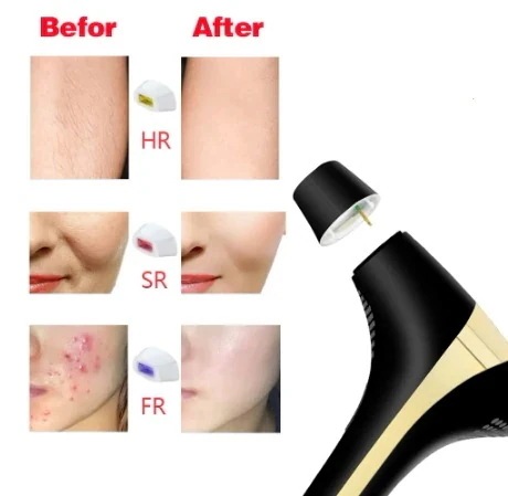 最安値挑戦！！！-人気No.1 無痛光美肌脱毛器 永久脱 痛みのない永久レーザー脱毛 新しいレーザー脱毛 2024