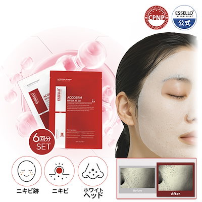 【値下げ！】炭酸パック Amazon | Sing 炭酸パック 濃密泡 ホワイトパック 洗顔