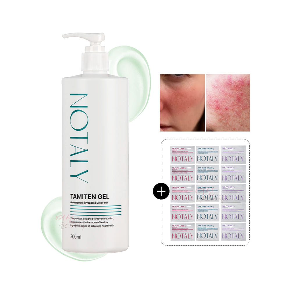 ノータリータミテンゲル 500ml 熱感鎮静水分敏感肌