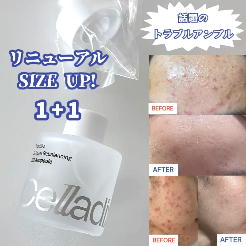 [1+1]131 ポア セラム30ml/アンプル皮脂軟化毛穴ケア,2個,30ml/ 皮脂改善 / ニキビ肌専用美容液 / ニキビ 肌荒れ ナイアシンアミド セラミド 毛穴