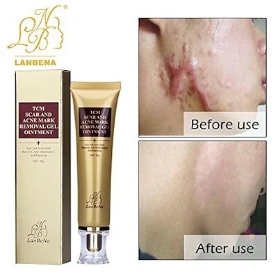 Wisdompark Acne Scar Removal Cream Skin Repair Fac