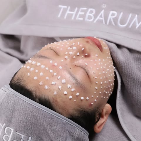 【THE BARUM】R2レディアンス リフレッシュスピキュール（ピーリング）　スピキュール入り　ハーブピーリング　棘　鍼　韓国式　韓国製造　肌質改善　肌管理　ホームケア　サロン品質