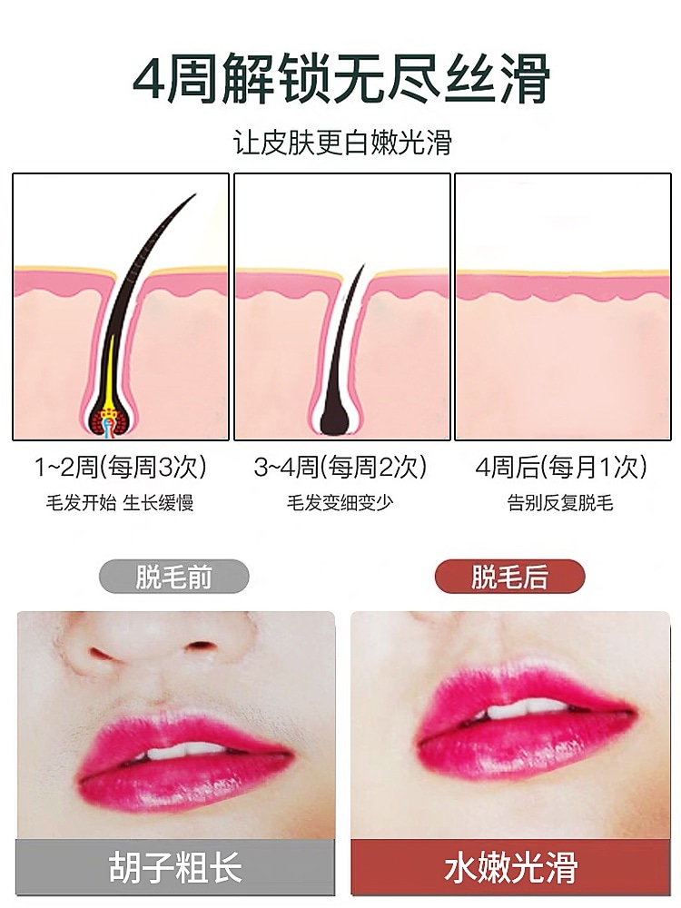 レーザー凝固点脱毛器ホームシェーバー全身脇の下唇の毛足の毛プライベートパーツ永久脱毛アーティファクト女性