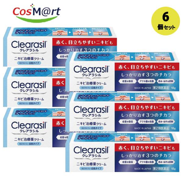 【6個セット】 【第2類医薬品】 【レキットベンキーザー・ジャパン株式会社】クレアラシル レギュラー18Ｇ(4906156100259-6)【ゆうパケットにて発送】