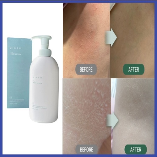 韓国ミルエン シカ 高保湿/極乾性/ボディローション 若芽エキス/肌保湿剤/香りの良い大容量500ml/ツボクサエキス/湿疹アトピーかゆみケア/妊婦/妊娠線/ベビーローション