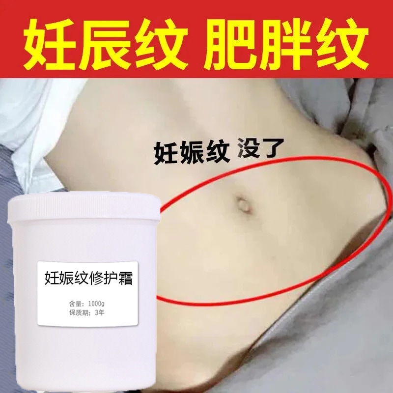 ストレッチマーク修復クリーム産後退色妊娠肥満マーク美容室スキンケア予防卸売 13,134円