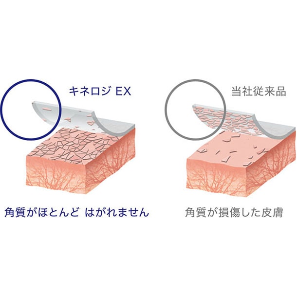 ニトリート NITREAT キネロジ EX テーピング用品 (NKEX37)