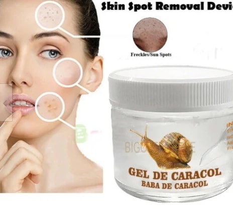 [アメリカへ無料直送] [プレミアム商品][満足度上位の製品] そばかす ダークスポット メラズマ