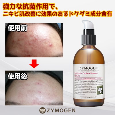 883286742.g_600-w-st_g.jpg