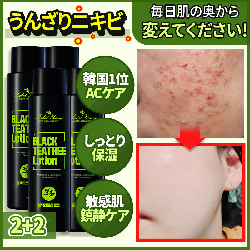 [2+2]にきびケアティーツリーエキス敏感肌のケアスキンケアショッキングブラックティーツリー乳液[韓国コスメLabel Young]