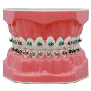 【最安値挑戦 送料無料】歯科矯正用歯モデル 1:1標準の歯科治療 回転ワイヤー付きの研究 金属ブラケット