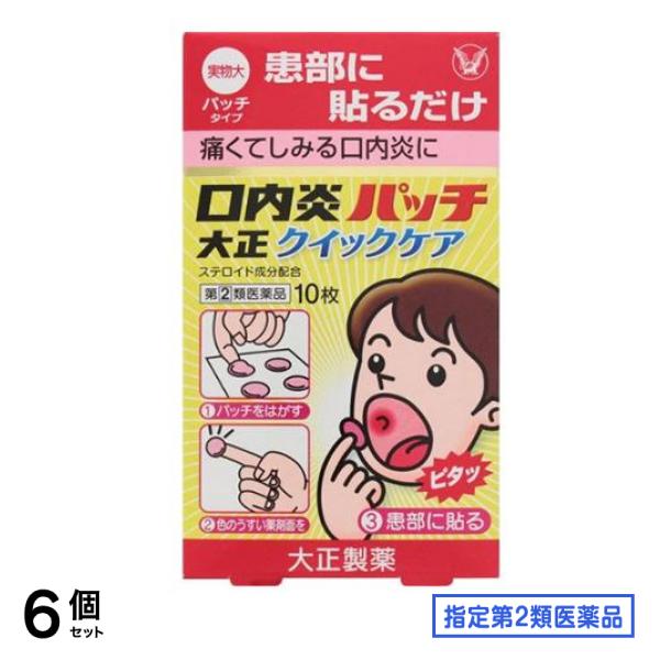 指定第２類医薬品 口内炎パッチ大正クイックケア 10枚 6個セット