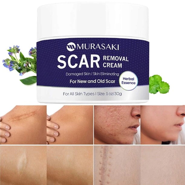 [アメリカ現地ウォールマート販売商品]ムラサキ傷跡除去クリーム傷跡処理-すべての肌タイプ新旧傷跡