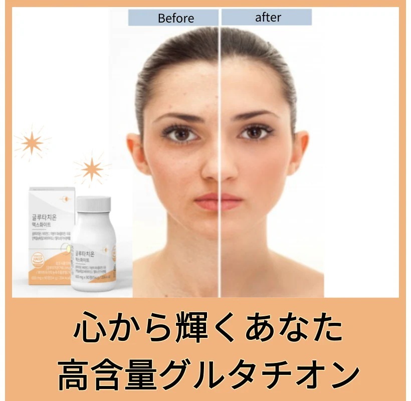 グルタチオン マックスホワイト/心から輝くあなたになってみてください/高含量
