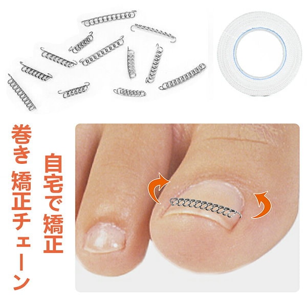 Qoo10] 巻き爪 矯正 巻き爪チェーン ワイヤー