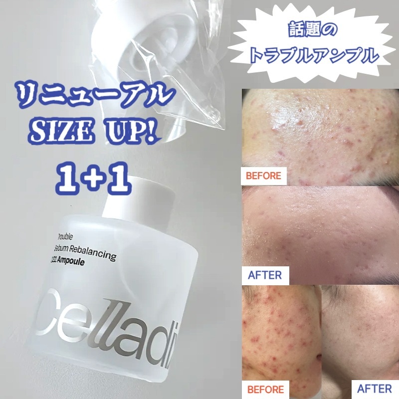 [1+1]131 ポア セラム30ml/アンプル皮脂軟化毛穴ケア,2個,30ml/ 皮脂改善 / ニキビ肌専用美容液 / ニキビ 肌荒れ ナイアシンアミド セラミド 毛穴