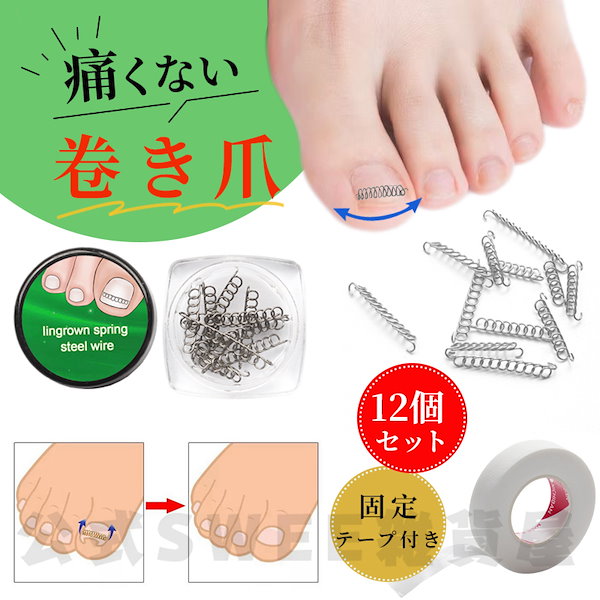 Qoo10] 【急速出荷】巻き爪 矯正 巻き爪チェーン