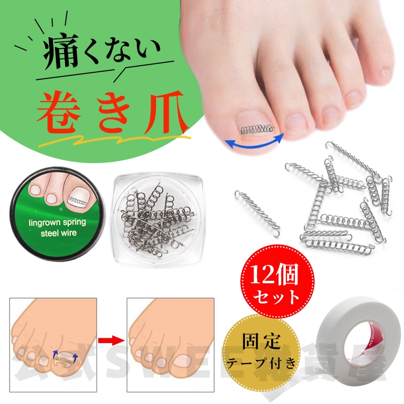 【急速出荷】巻き爪 矯正 巻き爪チェーン 治療 爪ワイヤー テープ付き 12個 自宅で治す 矯正器具 爪切り ネイルエイド セルフケア サポータ