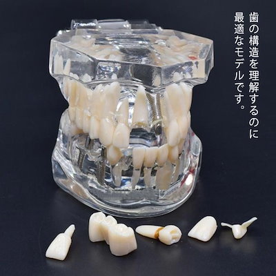 透明歯牙疾患模型 複製歯牙着脱模型 [PE-ANA009(I21D-400C)]｜株式会社ニッシン