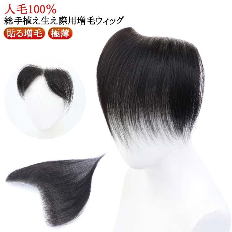 シール式 シール 貼る 生え際 生え際 部分ウィッグ 貼るウィッグ 黒 対策 生え際 M型 脱毛症 増毛シート 増毛 かつら ポイントウィッグ 脱毛症